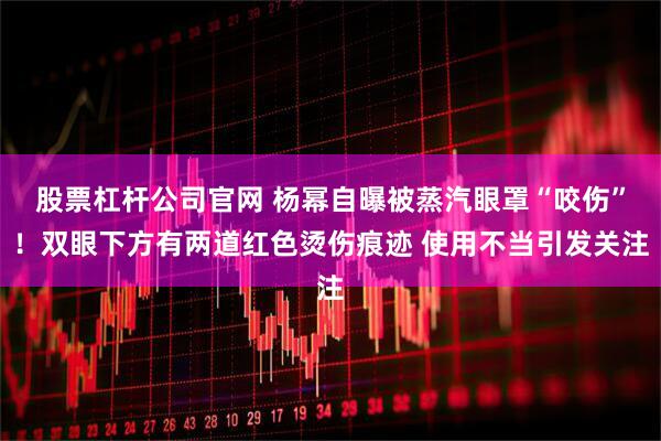 股票杠杆公司官网 杨幂自曝被蒸汽眼罩“咬伤”！双眼下方有两道红色烫伤痕迹 使用不当引发关注